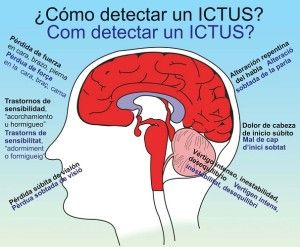 Ictus