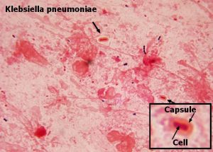 La superbacteria que resiste a (casi) todos los medicamentos antibióticos 3 klebsiella_pneumoniae bacterias