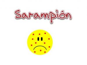 La mitad de las personas afectadas por el sarampión están bien vacunadas. ¿Eficacia de la vacuna cuestionable? 3 Sarampion1