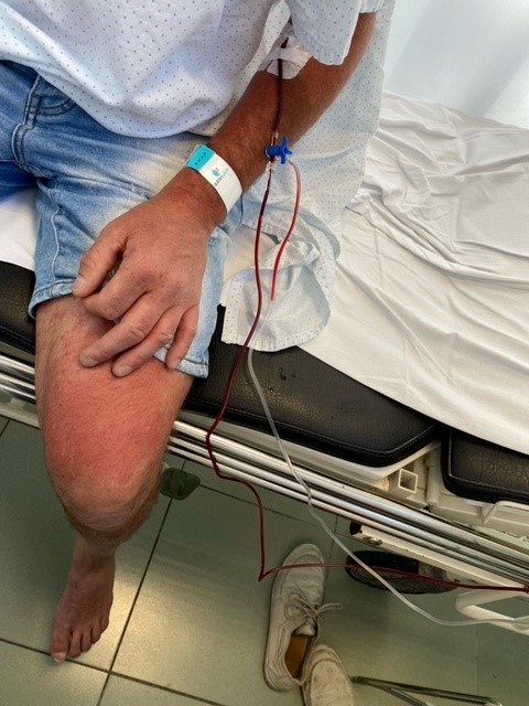 Sanidad conoce la "epidemia fantasma" de daños por el fármaco Nolotil y no hace nada porque es el más vendido 4 Sanidad conoce la «epidemia fantasma» de daños por el fármaco Nolotil y no hace nada porque es el más vendido