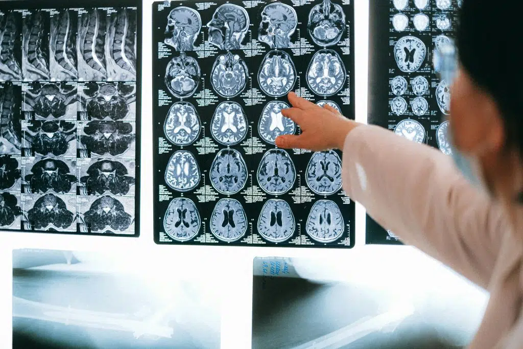Cerebro miguel jara